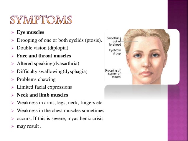 myasthenia-gravis-9-638