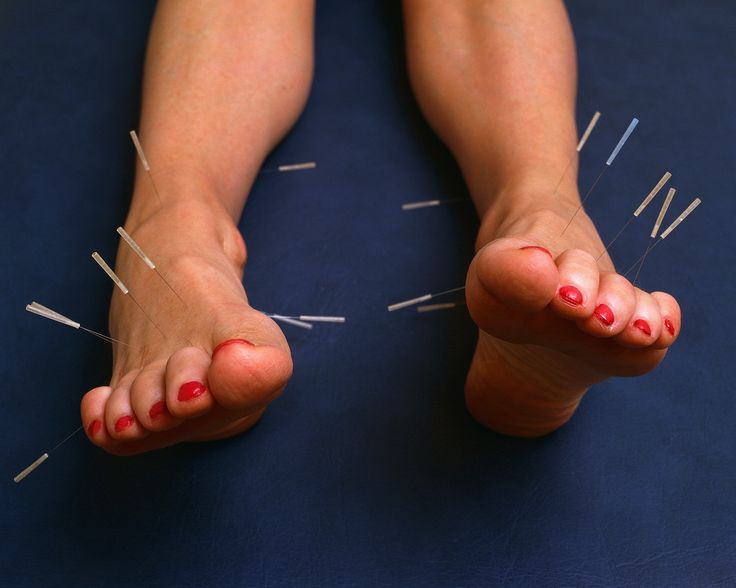 Acupuncture began before 2500 BC in China and is now used all over the world to treat disease and pain, to improve general health, and even as an anesthetic.  Metal needles are applied to certain points on the body, and the overall purpose of the treatment is to bring the  (female principle) and  (male principle) back into balance with one another.